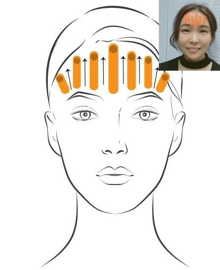 Kinesiology Tape Muscle Patch For Face